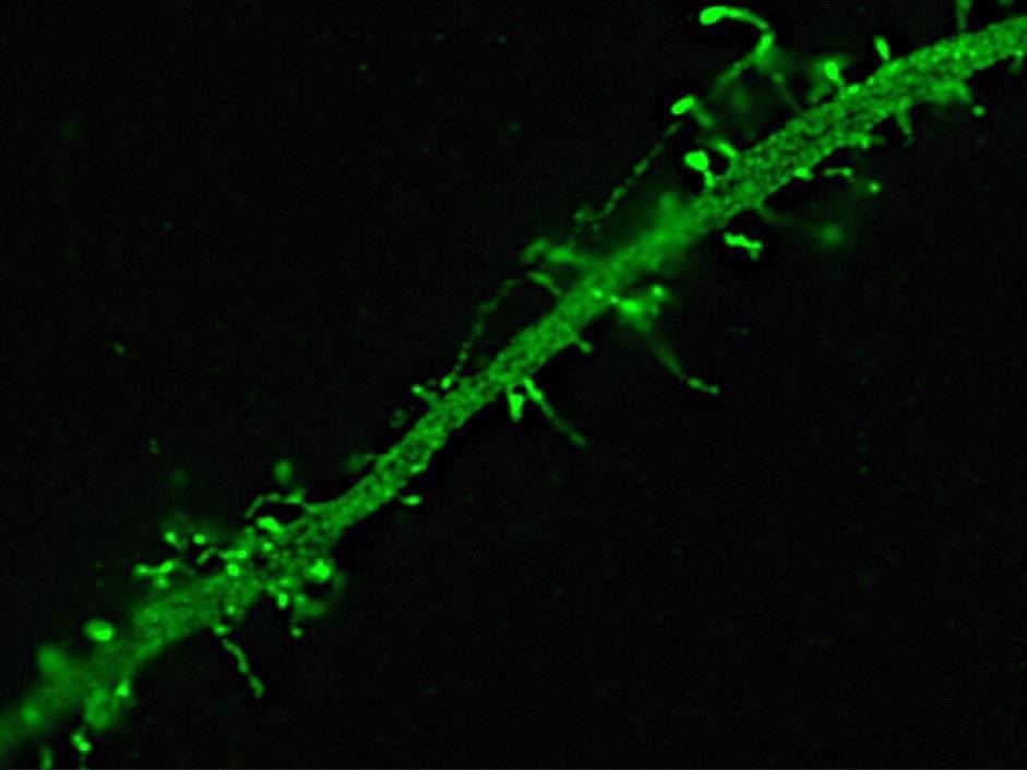 Dendrite of a neuron expressing Green Fluorescent Protein. Image acquired with structured illumination on an Elyra PS.1 showing spines on a dendrite.