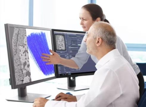 ZEISS PhaseEvolve: X-Ray Microscopy for Contrast Enhancement